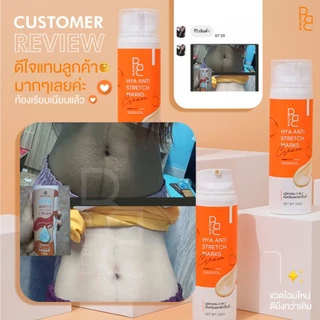 เซ็ทคู่ลดรอยแตกลาย Be Better ครีมน้ำตบสยบรอยแตก + เจลสมานผิว ครีมลดรอยแตกลาย จากทุกสาเหตุ