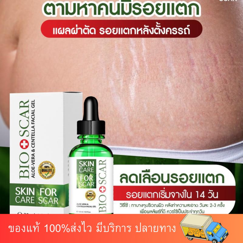 ไบโอสการ์ ลดรอยเเตกลาย เเพ้น้ำลายยุง 1 ขวด