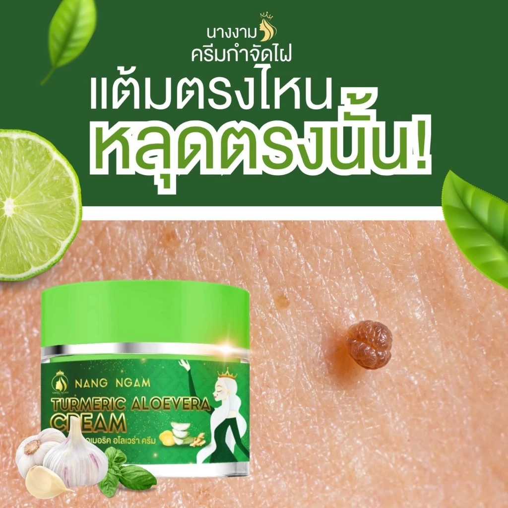 ครีมแต้มไฝ ขี้แมลงวัน ติ่งเนื้อ หูด ตาปลา แก้ปัญหา สิวหิน ครีมนางงาม ไฝ หูด จี้ไฝ แต้มไฝ