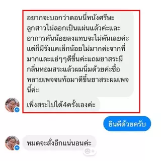 (เจ้าของ)เซ็ทครีม แชมพูและเซรั่ม รังแค หนังศีรษะลอก อักเสบ เซ็บเดิร์ม ต่อมไขมันอักเสบ สิวที่หัว