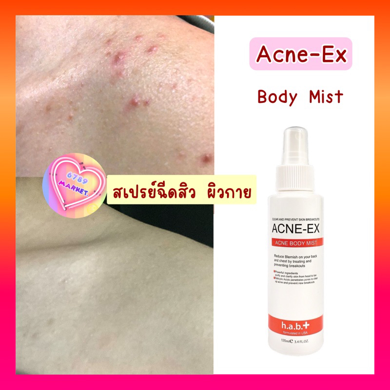 ลดพิเศษ Acne-Ex สเปรย์ฉีดผิวกาย (กดในไลฟ์สด/VDO โค้ดลดเพิ่ม30%) <ของเเท้> Acne-ex body spray 120 ml. (MK008)