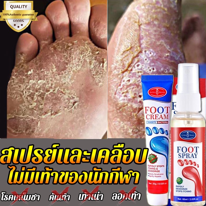 ถ้ารักษาไม่หายไม่คิดเงิน☞aichunครีมทาแก้เชื้อรา ของแท้100%ช่วยบรรเทาปัญหาเท้าลอกและมีกลิ่นได้อย่างรวดเร็วครีมลดกลิ่นเท้า