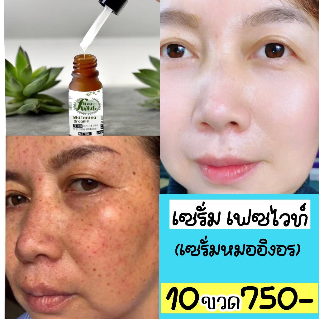 เซรั่ม Organic herbs “faceWhite” (เซรั่มหมออิงอร)  10 ขวด ❌ราคาปกติ 1000 ✅จัดโปรเพียง 750-