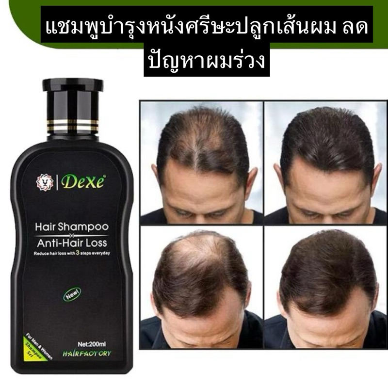 Dexe hair shampoo แชมพูบำรุงหนังศรีษะลดผมขาดร่วง
