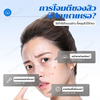 แผ่นแปะสิว แผ่นแปะดูดสิว แผ่นสติกเกอร์แปะสิว แผ่นสิว สําหรับติดตกแต่งสิว 200ชิ้น/ถุง รูปดาวน่ารัก