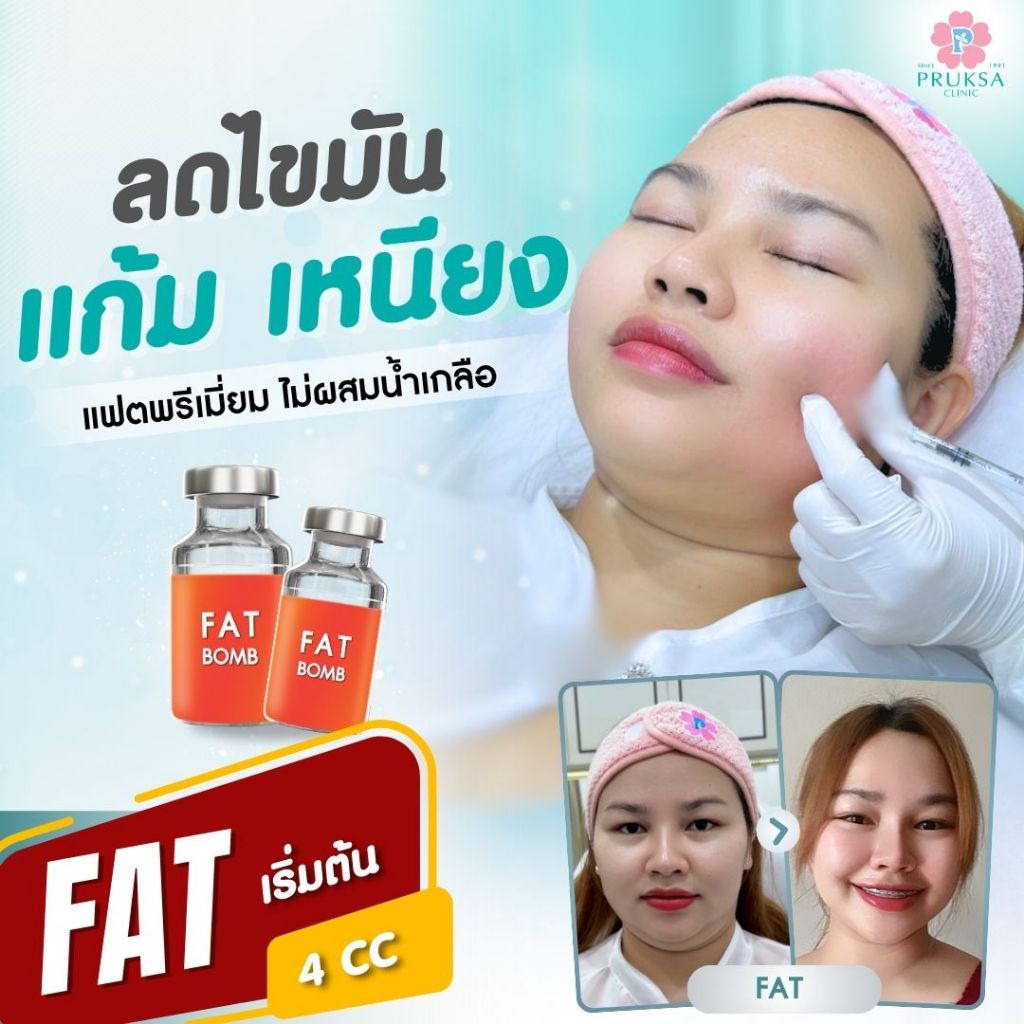 Pruksa Clinic Meso Fat ฉีดแฟตพรีเมี่ยม ไม่ผสมน้ำเกลือ