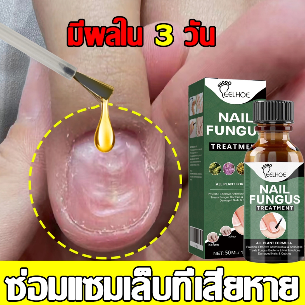 ของแท้ 100% EELHOE เซรั่มบำรุงเล็บ น้ำยาบำรุงเล็บ 50ml บำรุงเล็บ ต่อต้านการติตเชื้อรา ซ่อมแซมเล็บแตก เล็บเปราะ เล็บหนา