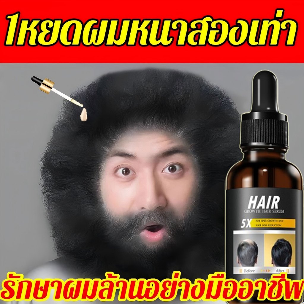 ผมขึ้นใหม่ใน1คืน กันร่วง ปลูกผมเติบโตและบํารุง4in1 เซรั่มปลูกผม ปลูกผม ป้องกันผมร่วง ยาปลูกผมของแท้ ปลูกผม น้ำยาปลูกผมดก