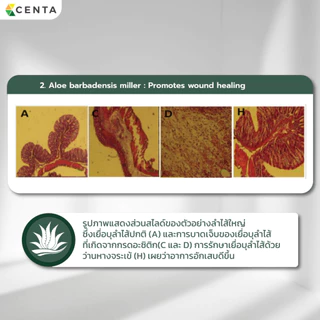 Centagel ซิลิโคนเจลเกรดการแพทย์ ลดโอกาสการเกิดรอยแผลเป็น ลดอาการคันจากแผลคีลอยด์ ลดการขยายตัวของแผลคีลอยด์ Medical Grade
