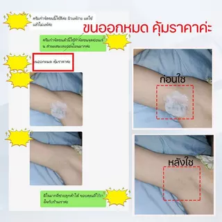 ครีมขจัดขนน้องสาว กำจัดขน แว็กขน กำจัดขนรักแร้ กำจัดขนที่ลับ อ่อนโยนต่อผิว ไม่เหลือตอ กำจัดขนจุดซ่อนเร้นถาวร น้องสาวเนี