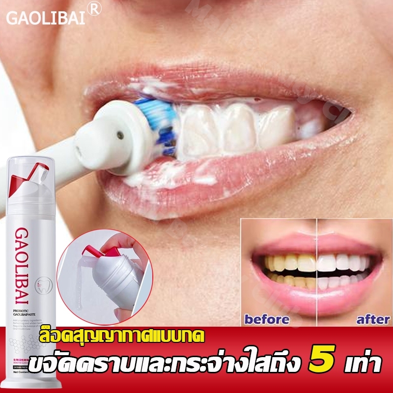 เทคโนโลยีใหม่ปี 2024 GAOLIBAI ฟอกฟัน ขจัดคราบฟันคราบควันคราบกาแฟ เพิ่มโปรไบโอติก ลดกลิ่นปาก ป้องกันฟันผุ ยาสีฟันฟันขาว