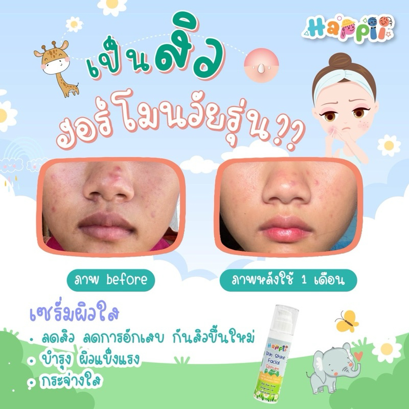 Happii Skin Shine Serum เซรั่มผิวใส สำหรับเด็ก-วัยรุ่น บำรุงผิว ลดสิว ปรับผิวกระจ่างใส กันแสงสีฟ้า