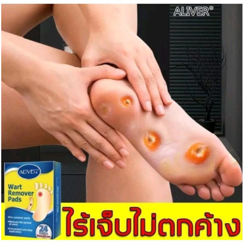 ALIVER แผ่นแปะตาปลา ใช้ได้บริเวณมือ และเท้า ผิว