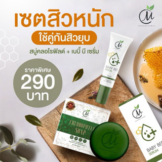 เซ็ตสิวหนัก เบบี้บี ชาร์มมิ่ง เซรั่มหยุดสิว สิวหนัก สิวติดสา…
