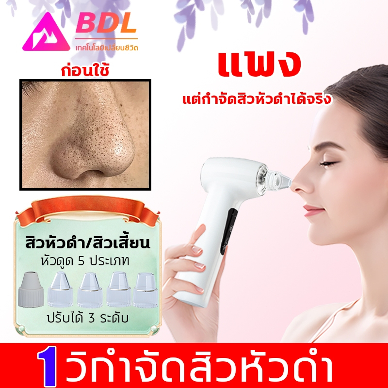 เครื่องดูดสิว เครื่องดูดสิวเสี้ยน สิวข้างจมูก ดูดสิวอุดตัน เครื่องดูดสิวสูญญากาศ Beauty Suction