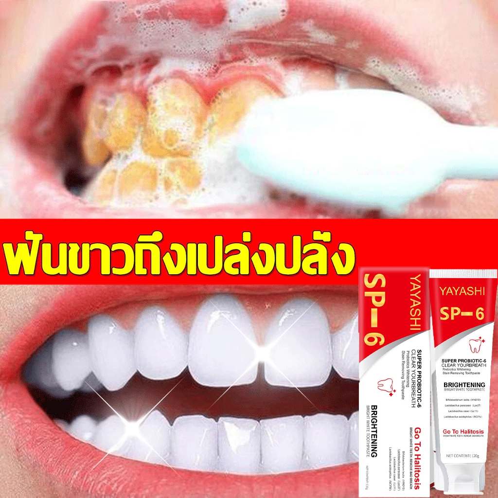 SP-6 ยาสีฟันฟันขาว ลบคราบฟัน คราบหินปูน ฟอกฟันขาวยาสีฟัน ฟันขาว ยาสีฟันฟอกขาว ยาสีฟันขจัดหิน 120 G