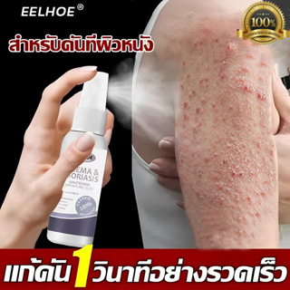 🔥ได้ผล 100% ไม่เด้งกลับ🔥EELHOEครีมต้านเชื้อแบคทีเรีย 30ml ผดผื่นคัน แพ้ แมลงกัดต่อย ไม่ระคายเคือง