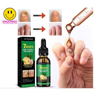 smile.price เซรั่มบำรุงเล็บ บำรุงเล็บขบ สูตรน้ำมันขิง เซรั่มทาเล็บ ดูแลเล็บ gingger nail oil serum 30ml.