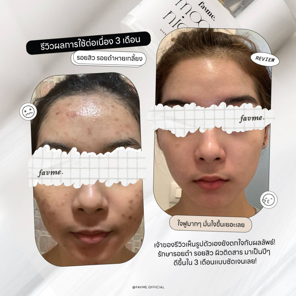 Lovelist เซตลดรอย เซรั่ม Fully Shine + ครีม Moon Night Cream - รูปที่ 3