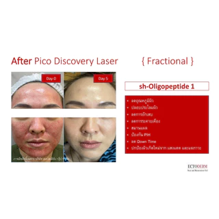 ECTODERM Scar and Restoration รักษาแผลตั้งแต่แรก แผลใหม่แผลหลังผ่าตัดสมานแผลแท้+แถม EXP.15/05/28