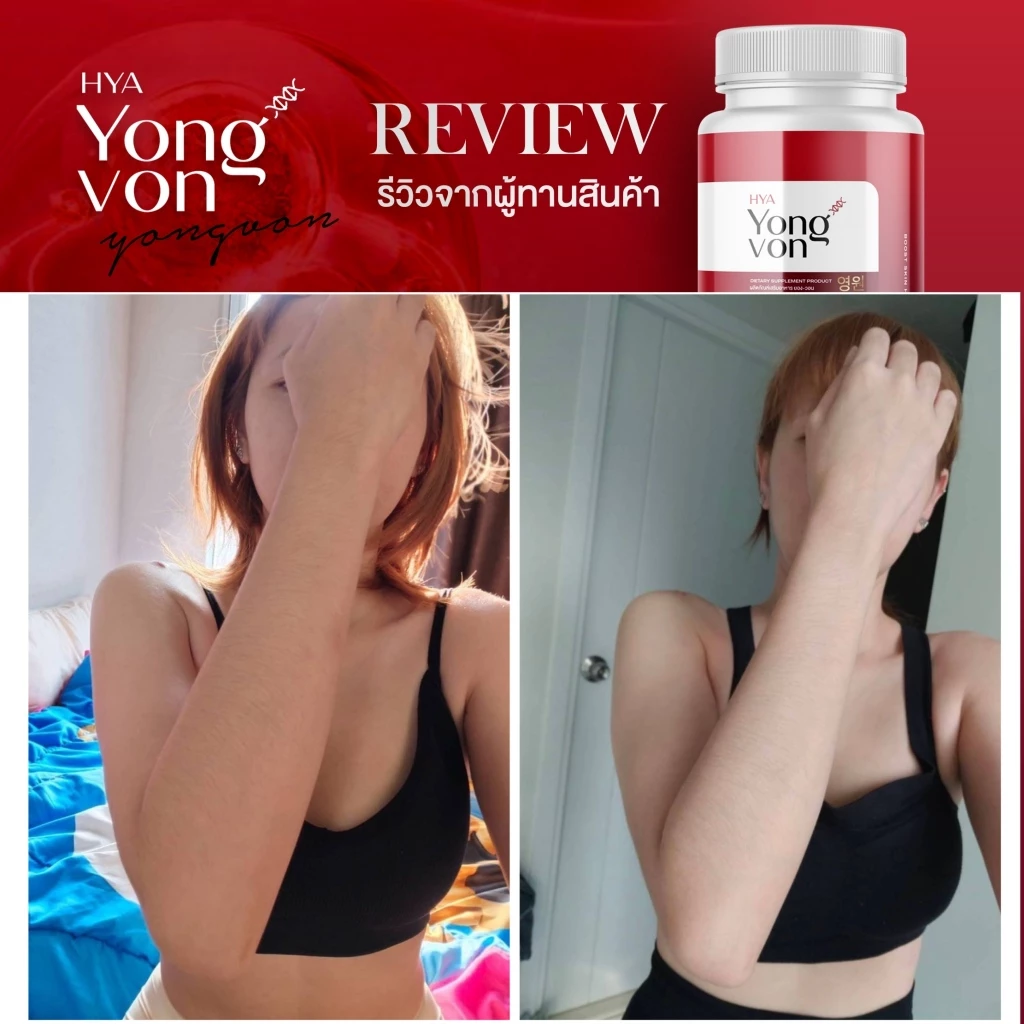 Yong Von กลูต้า ยองวอน thumbnail 10