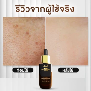 Yanhee Vita8 Cream |เซตผิวอิ่มฟู| ยันฮีไวต้าเอจ คอมเพล็กซ์ นวัตกรรมย้อนวัยผิว ล็อคผิวเด็ก
