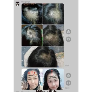 พร้อมส่ง🐧แชมพูแก้ผมบาง [มีของแถม] สูตรสมุนไพร 17 ชนิด ยาสระผมสมุนไพร แชมพูสมุนไพรคุณยาย สูตรคุณยาย