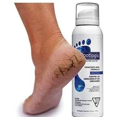 Footlogix mousse Cracked heel #3+ มูสทาเท้า สำหรับส้นเท้าแตก ของแท้นำเข้าจากCANADA พร้อมส่ง