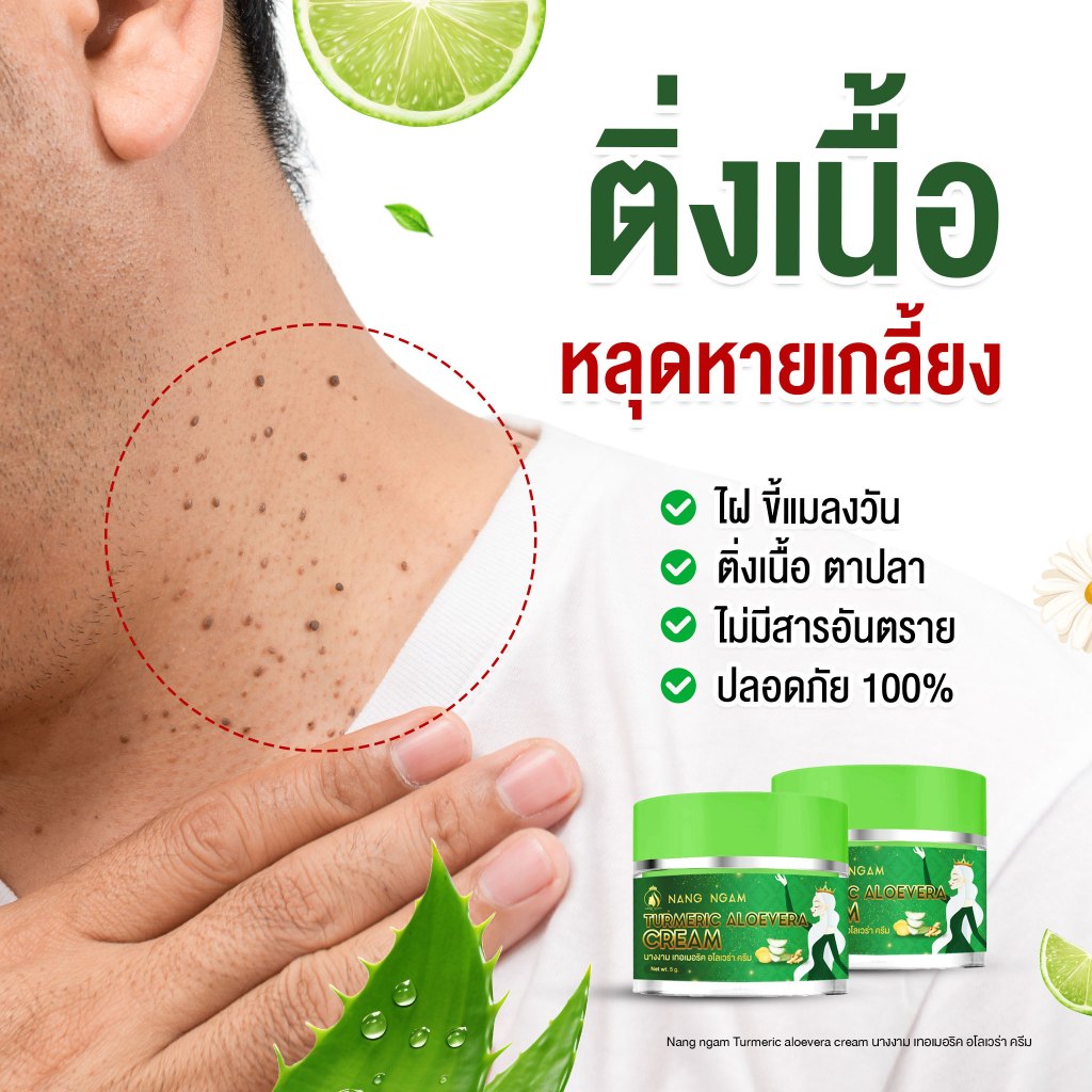 ครีมกำจัดไฝนางงาม ขี้แมลงวัน ติ่งเนื้อ หูด ตาปลา แก้ปัญหา กระ สิวหิน ครีมแต้มไฝนางงาม - รูปที่ 3