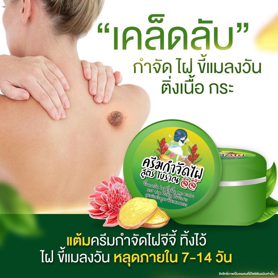 ครีมไฝจีจี้ ติ่งเนื้อ ตาปลา ขี้แมลงวัน หูด ไฝ แก้ปัญหา กระ สิวหิน ไฝ ตาปลา หูด จี้หูด แต้มไฝ