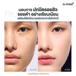 คุชชั่นลดสิว Dr.PONG ACNE ACE LONGWEAR CUSHION คุมมัน ติดทนกันน้ำ ไม่หลุดง่าย ยืนยันด้วยงานวิจัย