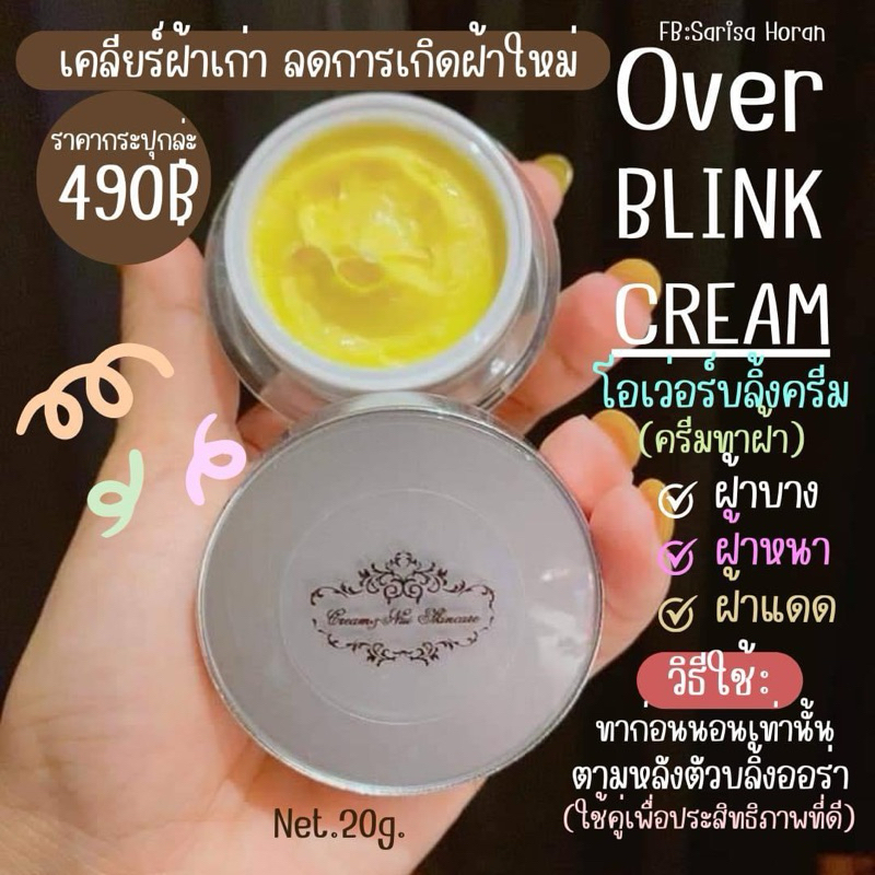 ครีมฝ้า โอเวอร์บลิ้งครีม Over Blink Cream***ขนาดใหญ่ 20 กรัม***