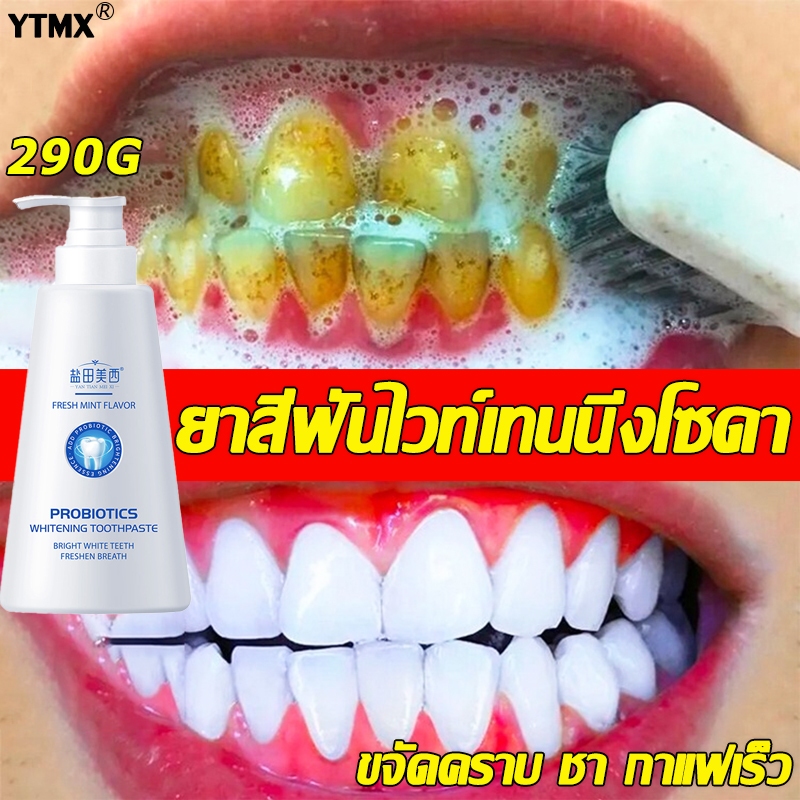 🔥พร้อมส่ง🔥ยาสีฟันฟันขาว 290g ขจัดคราบ ชา กาแฟเร็ว บอกลาฟันเหลือง