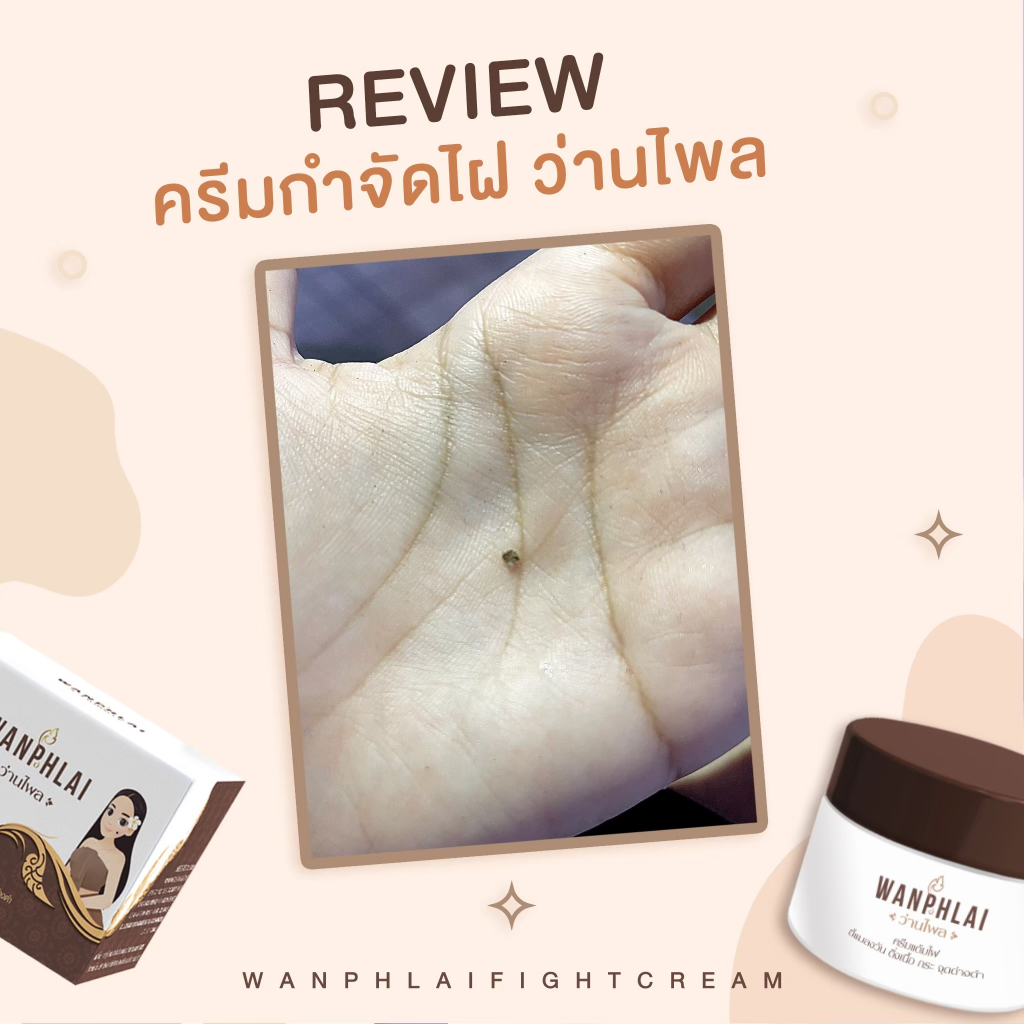 ครีมแต้มไฝ ว่านไพล ขี้แมลงวัน ติ่งเนื้อ หูด สิวหิน  แก้ปัญหา ตาปลา ครีมแต้มไฝ ว่านไพล ไฝ หูด จี้ไฝ - รูปที่ 3