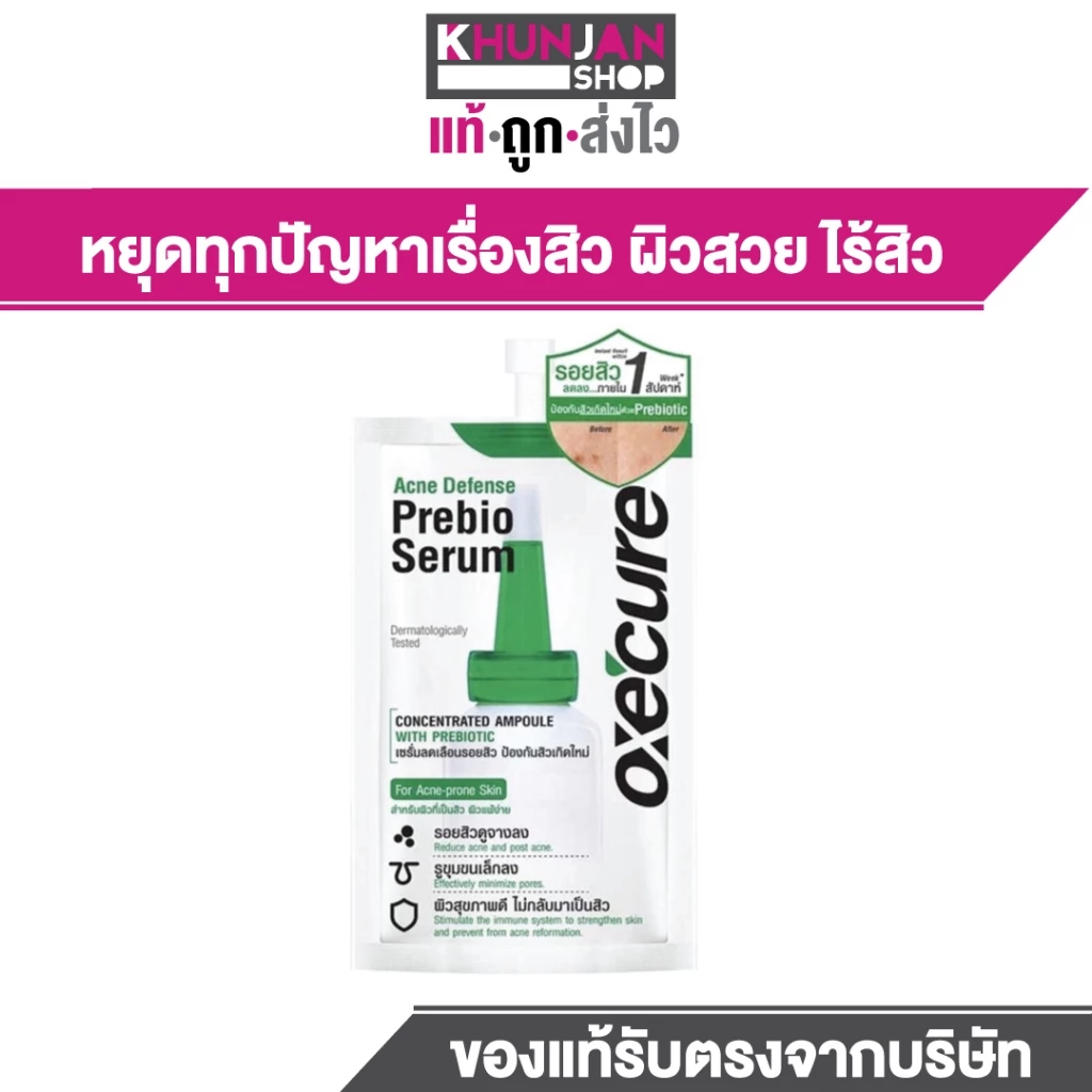 Oxe 'cure Acne Defense Prebio Serum 5 ml. - อ๊อกซี เคียว แอคเน่ ดีเฟนส์ พรีไบโอ เซรั่ม 5 มล. เซรั่มลดรอยสิว ลดการอักเส