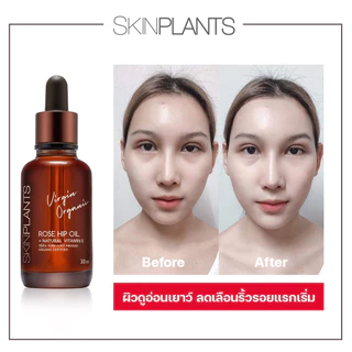 SKINPLANTS Rose Hip Oil 30 ml. ออยล์ลดรอยแตกลาย จุดด่างดำ ริ้วรอยเหี่ยวย่น ซ่อมแซมผิว