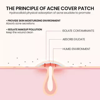 (มีส่งด่วน) JAYSUING PIMPLES PATCH แผ่นแปะสิว ลดจุดด่างดํา ซึมซับสิวอย่างอ่อนโยน 200 PATCHS