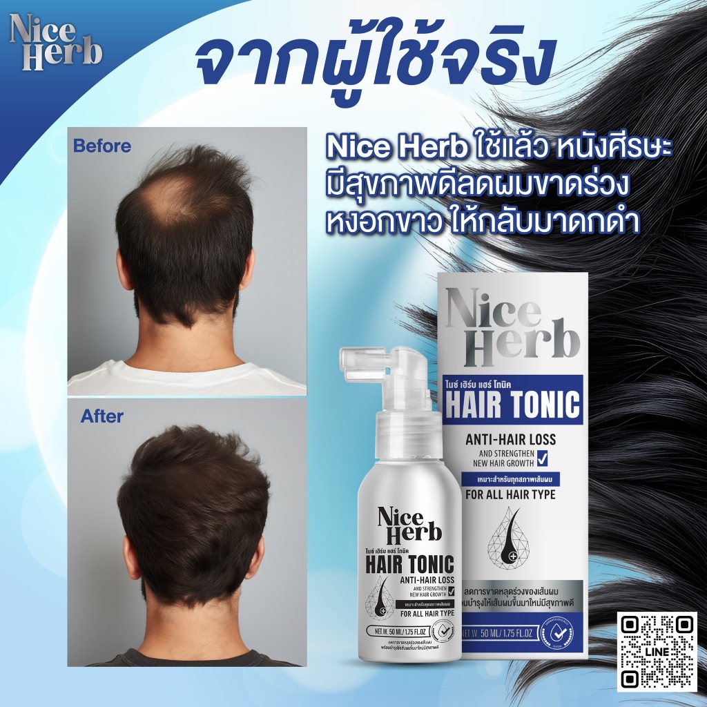 HAIR TONIC แฮร์โทนิค เซรั่มปลูกผม ปลูกคิ้ว เห็นผลไว เข้มข้นขึ้นเร็วแท้100% ลดหงอก ไนซ์เฮิร์บ(Nice Herb) 50ml. ส่งฟรี