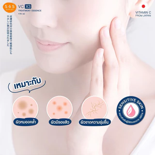 ❎EXP.02/27 | SOS VC X3 Treatment Essence เอะสึ โอ เอะสึ วีซี เอ็กซ์ 3 ทรีทเมนท์ เอสเซนส์ 170 มล.