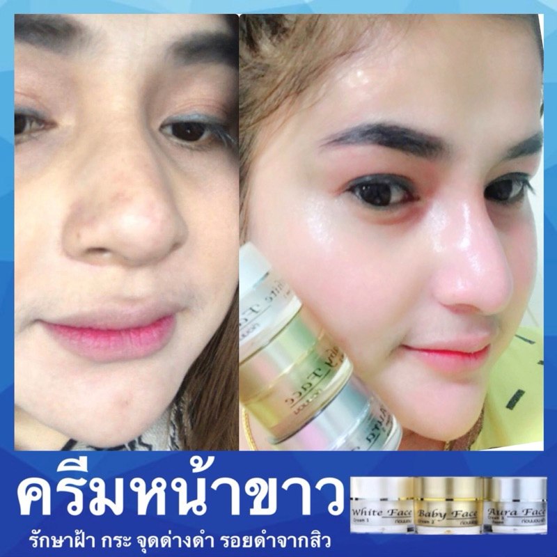 ครีมหน้าขาวใส ลดสิว ฝ้า ฃดรอยสิว ครีมหน้าใส รักษาสิว ครีม หน้าเด็ก ริ้วรอย ผิวแข็งแรง หน้าใส หน้าขาว