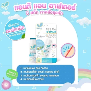 (ส่งด่วน/ส่งทันที🔥) Umbili Aiaoon บาล์มทาหลังยุงกัด บาล์มบัวหิมะ สูตรออแกนิค ไออุ่น อ่อนโยนต่อผิวเด็ก