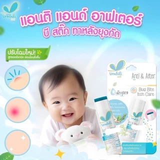 (ส่งด่วน/ส่งทันที🔥) Umbili Aiaoon บาล์มทาหลังยุงกัด บาล์มบัวหิมะ สูตรออแกนิค ไออุ่น อ่อนโยนต่อผิวเด็ก