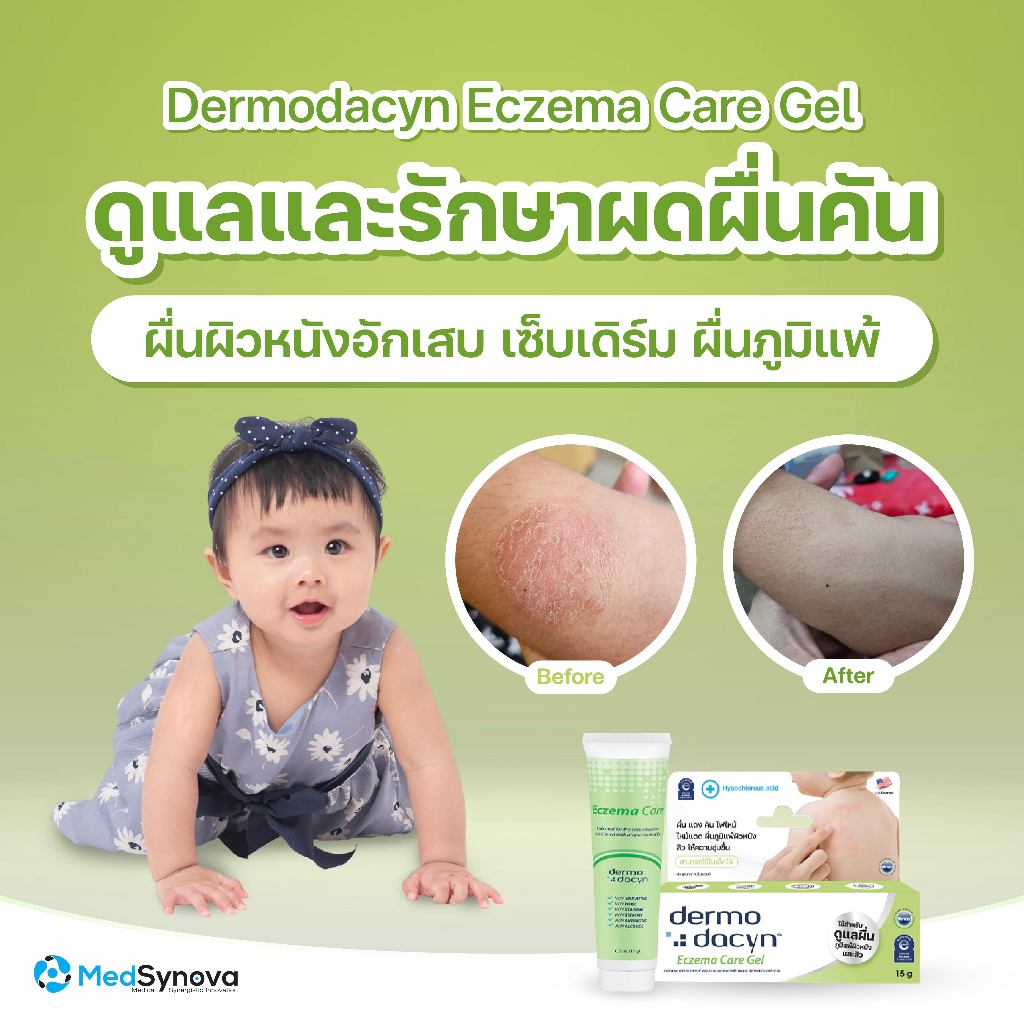 Dermodacyn Eczema care gel  เจลลดการ อักเสบ ดูแลผดผื่น