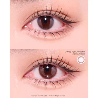 💥1 แถม 1 กด 2 คู่💥เลนส์น้ำตาเทียม HYALURON 💦 คอนแทคเลนส์พรีเมี่ยม อมน้ำ 62% Mocha Mousse 0.00-6.00