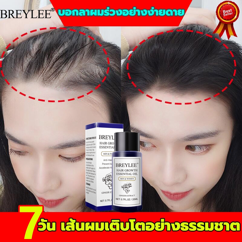 เซรั่มบำรุงผม20ml สารสกัดจากขิง น้ำยาปลูกผม เซรั่มปลูกผม น้ำยาปลูกผมดกHair Essence ซ่อมแซมผมเสีย เร่งผมยาว ป้องกันผมร่วง