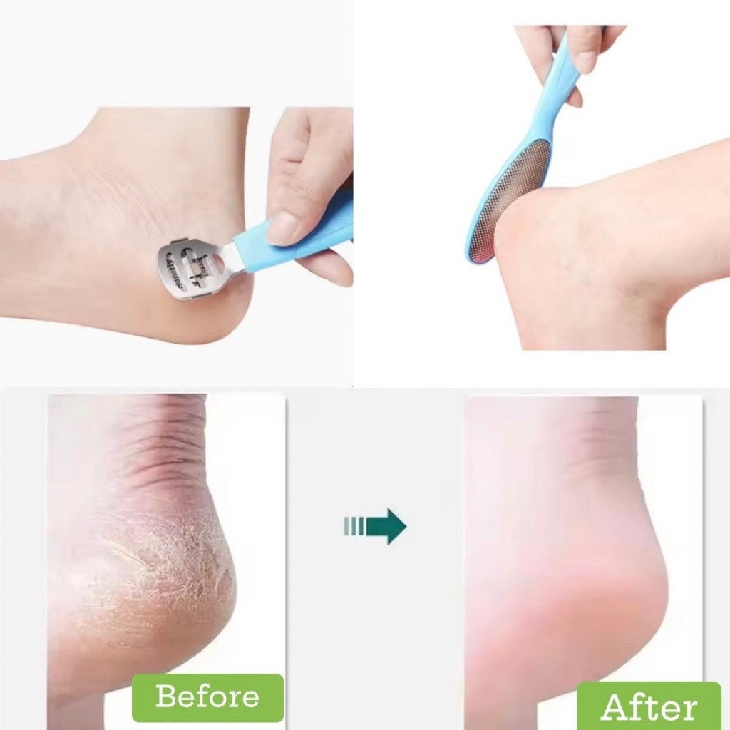 (สินค้าส่งจากไทย) SET ตะไบขูดส้นเท้า 8ชิ้น ช่วยกำจัดส้นเท้าแตก ผิวหนังแห้งกร้าน ให้กลับมาดูดี - รูปที่ 4