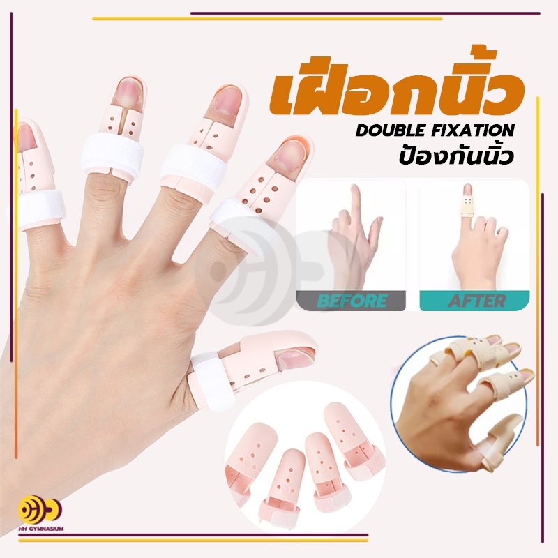 เฝือกนิ้ว มือพลาสติกสีเนื้อ ป้องกันการงอข้อปลายนิ้ว  mallet finger สำหรับนิ้วล็อค ใช้ดามนิ้วสำหรับการรักษา