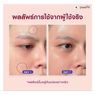 💧 จุด่างดำหาย 💧smooto สมูทโตะ เรด ไวน์ ไบร์ทเทนนิ่ง บูสเตอร์ เซรั่ม Red wine bright booster serum 8g.