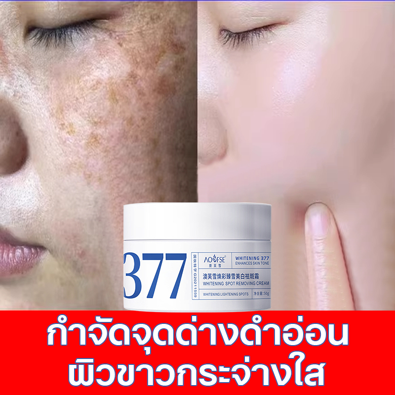 377ครีมแก้ฝ้าผิวขาว อุดมไปด้วยไนอาซินาไมด์ ยับยั้งการสร้างเมลามิน ทาผิวขาว แก้ฝ้าบนหน้า เติมเต็มความชุ่มชื้นแก่ผิว