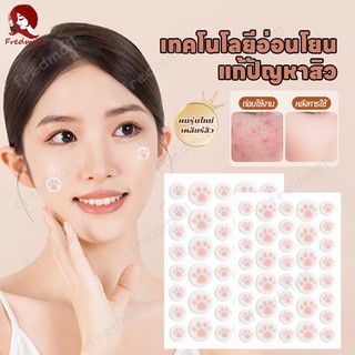 แผ่นสิว สําหรับติดตกแต่งสิว แผ่นแปะดูดสิว แผ่นสติกเกอร์แปะสิว แผ่นดูดสิวน่ารักอุ้งเท้าแมว กันน้ำ